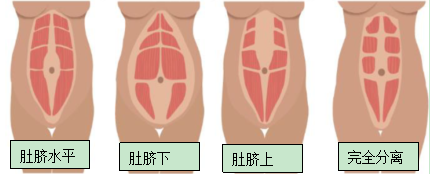 TIM图片20180926105602.png